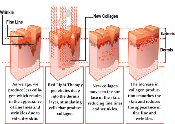collagen and aging